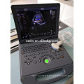 DW-C60 DAWEI portable ordinateur portable 4D couleur Doppler échographie machine prix usine avec l&#39;approbation de l&#39;ISO CE